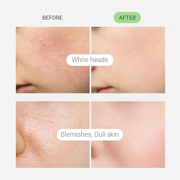 TENZERO CICA Bubble Toner, 4.73 fl oz/140ml, Hydrating & Soothing Centella Toner for Face, Barrier Repair, Korean Bubble Skincare - Image 3