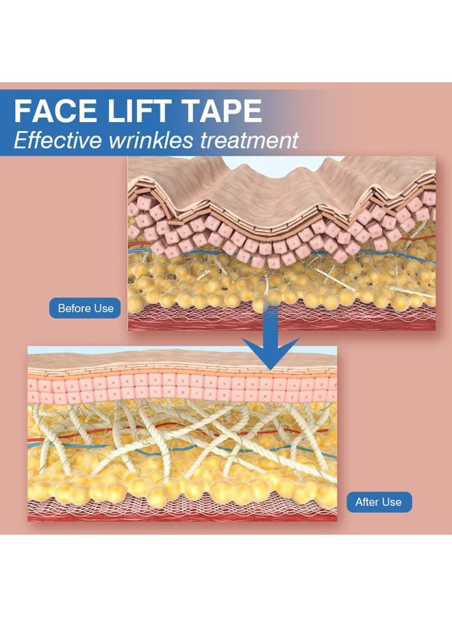 Sfuchin Facial Patches - Wrinkle Patches - Wrinkle Tape - Face Lifting Tape - Non-Invasive Wrinkle Remover - Multifunctional High Elasticity Wrinkle Forehead Eyes Face Neck Wrinkle Treatment - 2.5CM*1000CM - Image 3