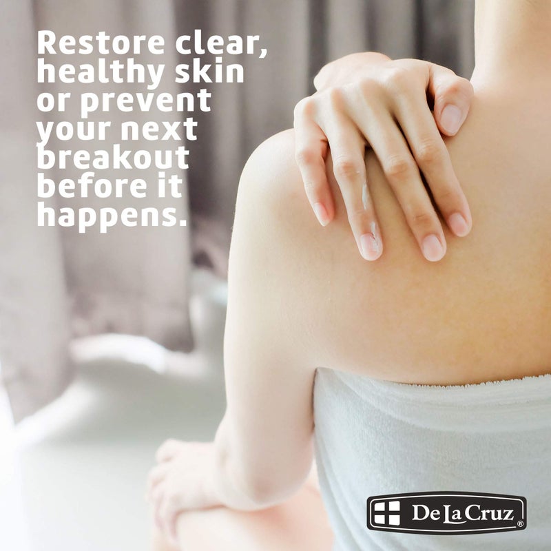 De La Cruz 10% Sulfur Ointment - Cystic Acne Treatment for Face and Body - Daily 10 Min Spot Treatment Mask Safe and Effective Game Changing Hormonal Acne Treatment that Clears Up Pimples 2.6oz 6 Pack - Image 3