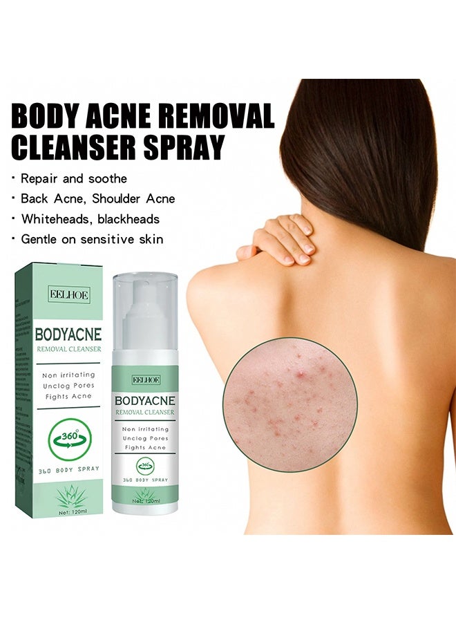 EELHOE Body Acne Removal Cleanser Spray, Back Acne Treatment, Back Acne Spray, Body Acne Marks Repair Back Shoulder Acne Skin Care Spray,120ml - Image 1