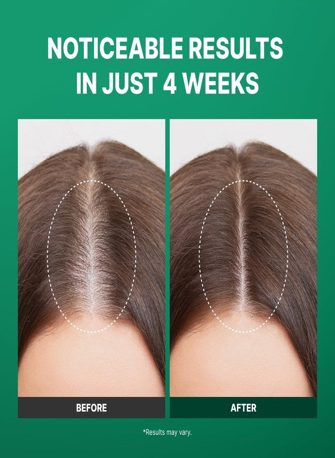 Fromforet Spicule Microneedling Exosome Hair Growth Serum, Hair Loss Treatments for Women and Men, Peppermint Oil Cooling Scalp Serum, Menthol, Korean Hair Care (0.5 fl oz / 15ml) - Image 2
