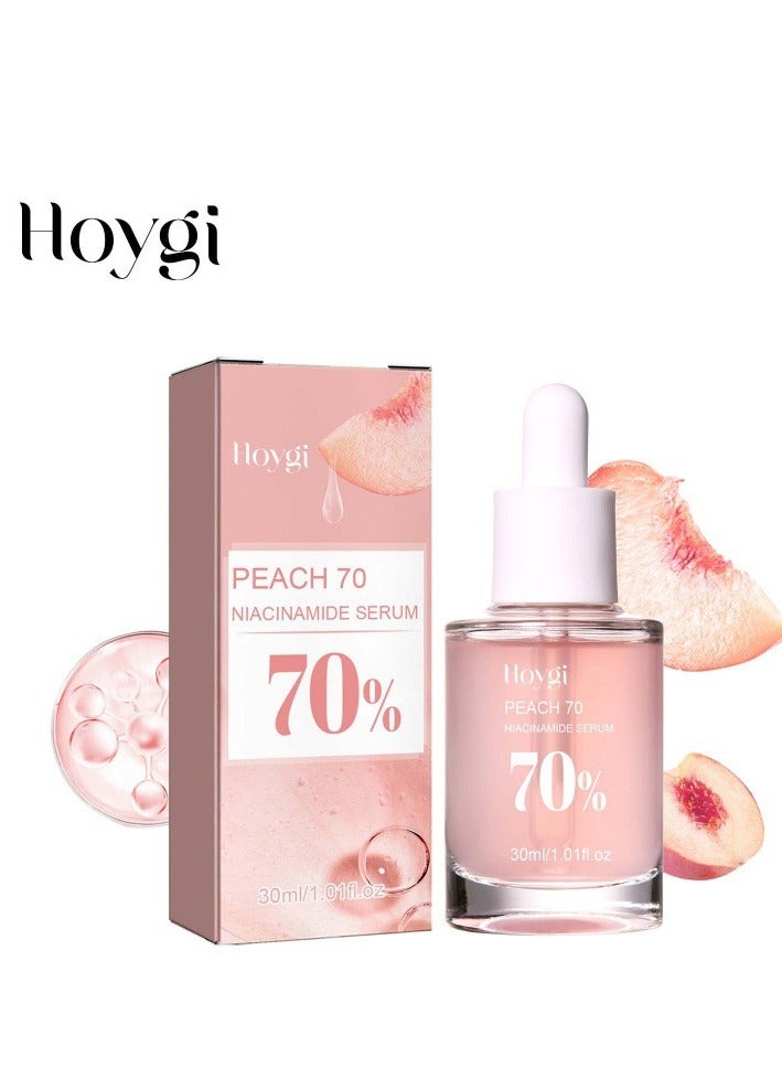 هويجي مستحضر هويجي نياسيناميد لشد البشرة وترطيبها وتقليل ظهور علامات حب الشباب والخطوط الدقيقة والبقع وتجديد البشرة وترطيبها وتبييضها 30 مل - Image 1