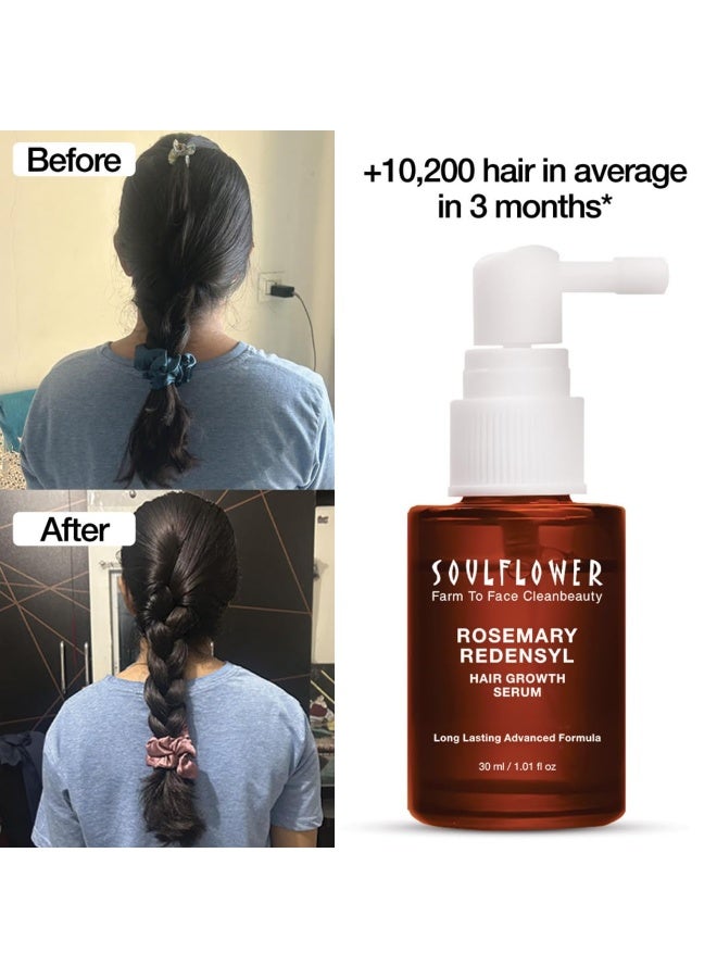 Soulflower Hair Growth Serum, Rosemary Oil, 3% Redensyl, 4% Anagain, , Melanogray, Biotin, Rice Water, Clinically Tested on Real people, Hair growth & Hair fall control for Women & Men | 30ml - Image 2