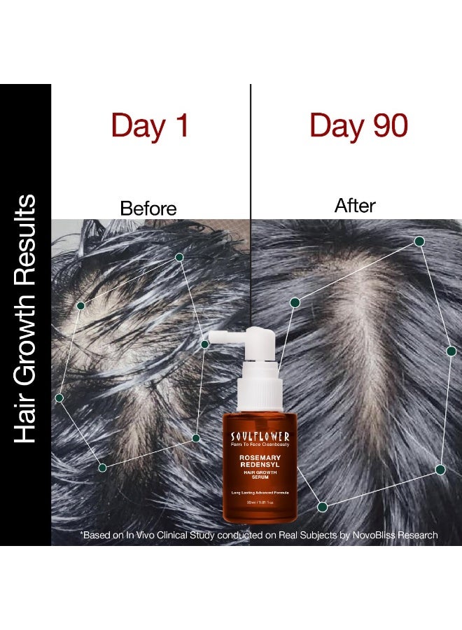 Soulflower Hair Growth Serum, Rosemary Oil, 3% Redensyl, 4% Anagain, , Melanogray, Biotin, Rice Water, Clinically Tested on Real people, Hair growth & Hair fall control for Women & Men | 30ml - Image 3