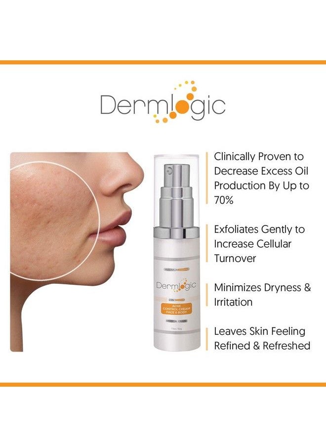 Dermlogic - كريم وجه وجسم لعلاج القوة القصوى لحب الشباب للبثور السوداء والبيضاء. يمنع ظهور الحبوب المستقبلية. يستخدم على الوجه والجسم والصدر والظهر للمراهقين والبالغين. - Image 1