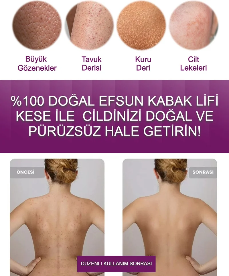 Efsun Natural Pumpkin Scrub Fiber, Ends Cellulite, Ingrown Hairs and Acne, Special Peeling Effect