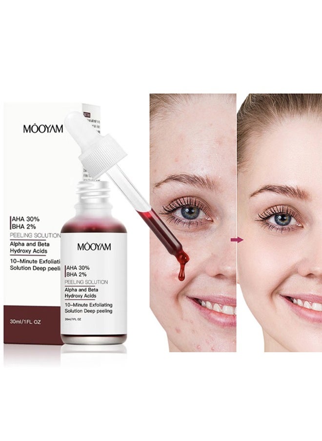 MOOYAM AHA 30% BHA 2%- Peeling Solution- Alpha and Beta Hydroxy Acids-Peeling Solution Anti Acne Serum,Chemical Peel for Face at Home,BHA+AHA  Liquid Exfoliant for Blemishes Wrinkle 30ml  - Image 1