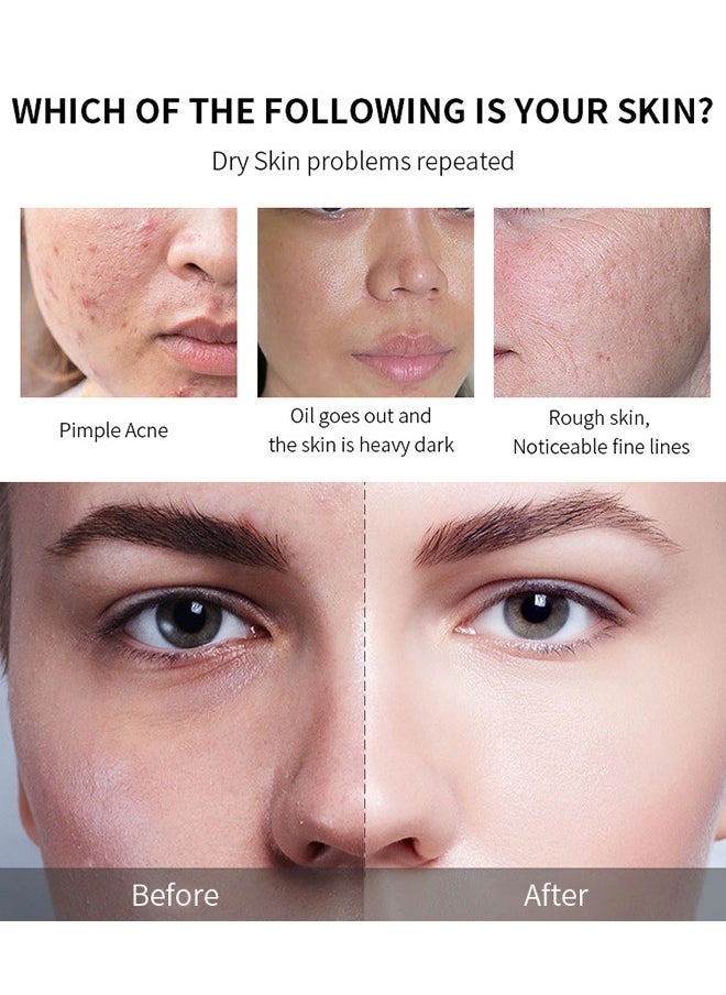 MOOYAM AHA 30% BHA 2%- Peeling Solution- Alpha and Beta Hydroxy Acids-Peeling Solution Anti Acne Serum,Chemical Peel for Face at Home,BHA+AHA  Liquid Exfoliant for Blemishes Wrinkle 30ml  - Image 5