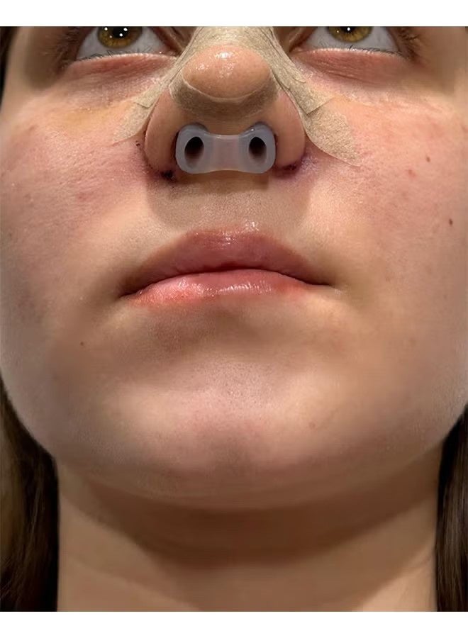 Nostril Retainer Short Model, Nasal Retainer Rhinoplasty & Nose Splint for Rhinoplasty Recovery, 100% High Grade Silicone, Nostril Retainer Size (No. 7) - Image 5