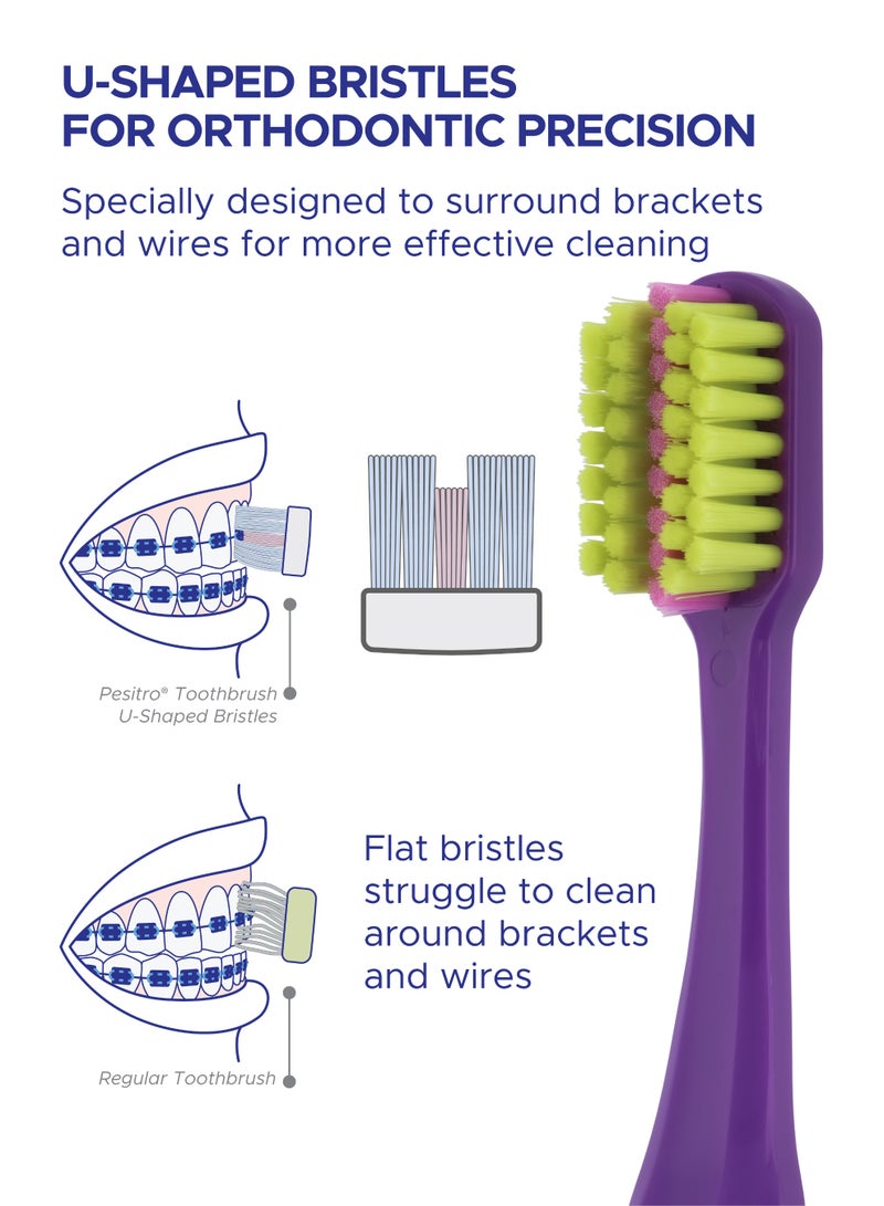 PESITRO UltraClean 6580 Ultra Soft Ortho Toothbrush – U-Shaped Orthodontic Brush with 6,580 Ultra-Soft Bristles - Image 3