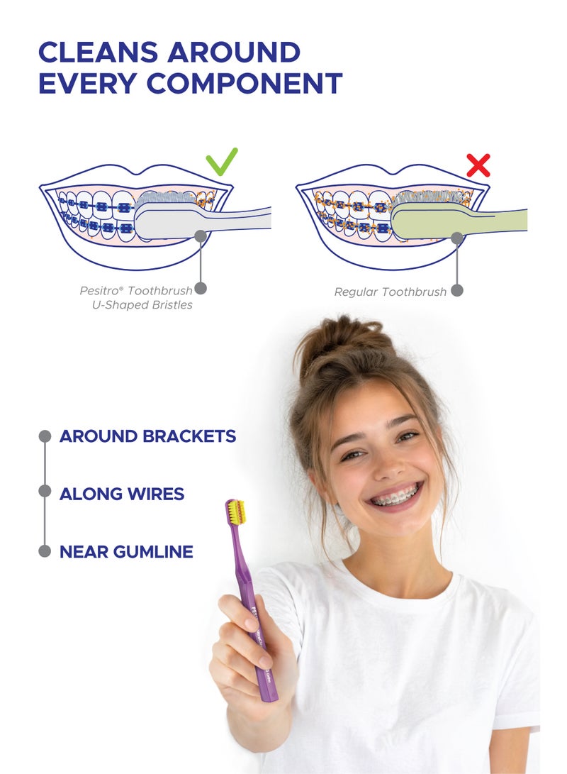 PESITRO UltraClean 6580 Ultra Soft Ortho Toothbrush – U-Shaped Orthodontic Brush with 6,580 Ultra-Soft Bristles - Image 5