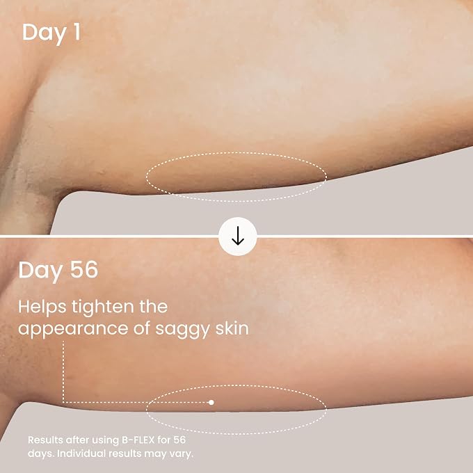 Maelys MALYS B-FLEX Lift & Firm Arm Cream - Firming Cream For Tighter and Firmer-Looking Arms - Helps Reduce The Appearance of Loose & Crepey Skin - Image 3