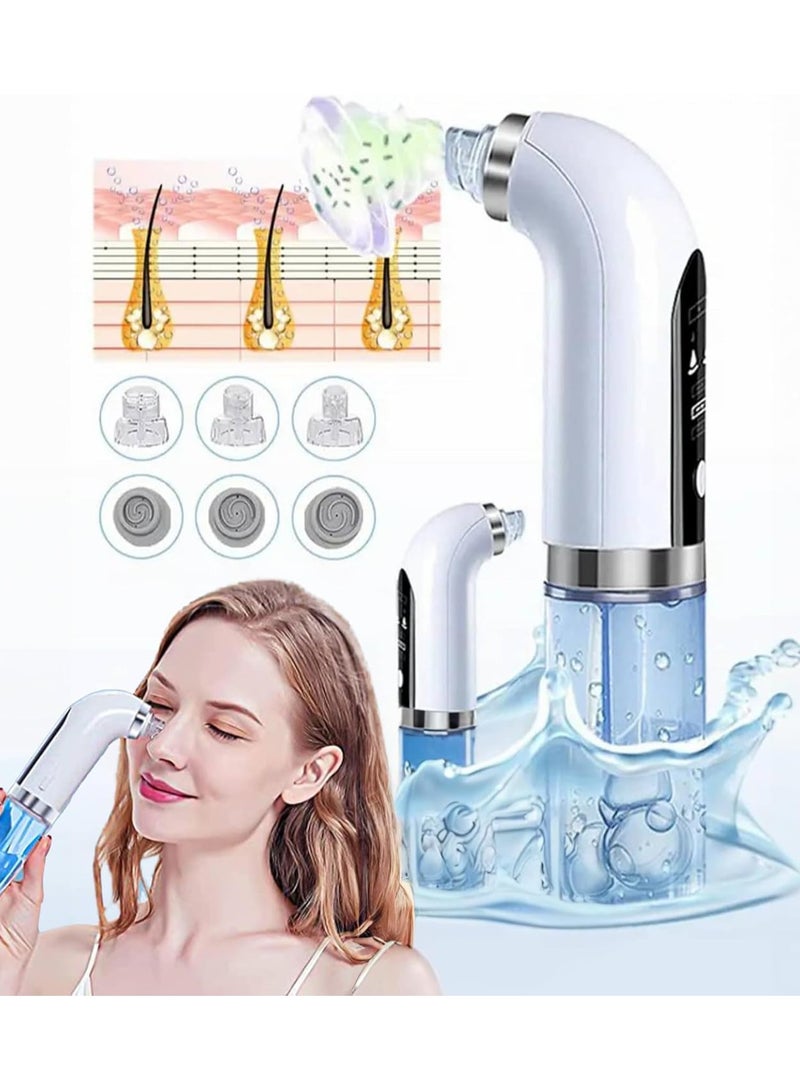 amazing.EGP Blackhead Remover Vacuum, 5 Suction Levels, 4 Probes, USB Rechargeable Pore Cleaner (White) - Image 1