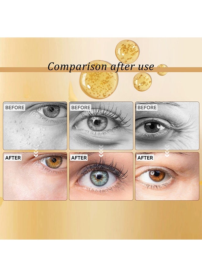 Advanced Snail Peptide Eye Cream, For Dark Circles, Puffiness And Wrinkle, Niacinamide And Snail Mucin Eye Cream, Moisturizing, Hydrating, Firming, 360° Massage Ball, 17ML