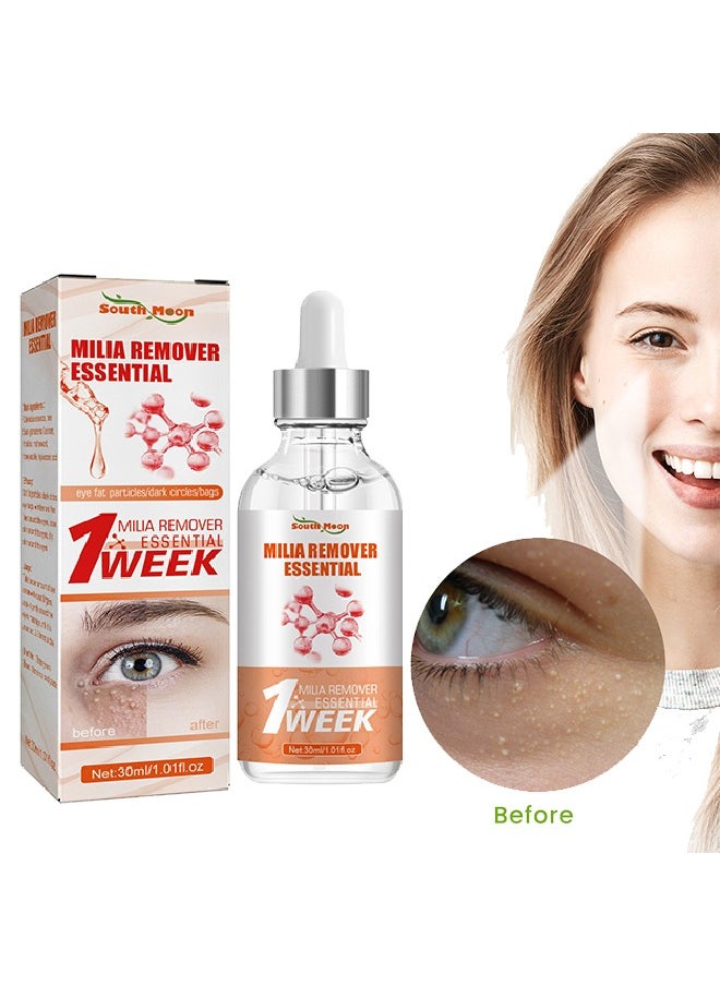 SOUTH MOON Milia Removal Essential, Milia Spot Treatment Helps Dissolve And Reduce Milia, Whitehead And Sebaceous Hyperplasia 30 ML  - Image 1