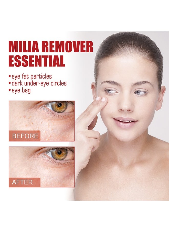 SOUTH MOON Milia Removal Essential, Milia Spot Treatment Helps Dissolve And Reduce Milia, Whitehead And Sebaceous Hyperplasia 30 ML  - Image 2