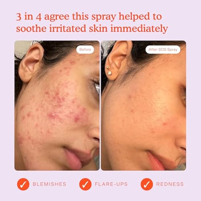 Tower 28 SOS Daily Rescue Facial Spray for Sensitive Skin, Hypochlorous Acid Spray Helps Reduce Redness and Breakouts, Full Size Toner for Face, 4 FL Oz - Image 4