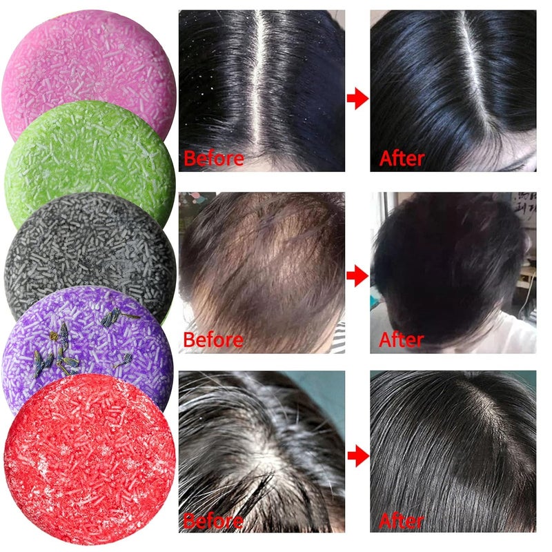 DBEAUTYM 8 Pack Shampoo Bar Gift Set,Natural Soap, Solid Dry Damaged Hair With Plant Essence Oil Helps Stop Loss and Promotes Healthy Growth, Travel Size Bulk Set - Image 5