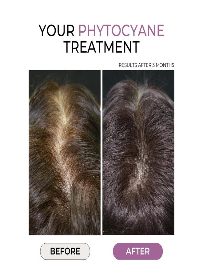 Phyto مكمل غذائي PHYTOCYANE لمكافحة تساقط الشعر (إمداد لمدة 12 أسبوعًا)، 84 حبة (عبوة من 1)، 1 كبسولة يوميًا، نباتي، خالي من اللاكتوز، خالي من الجلوتين، بدون مواد حافظة - Image 2