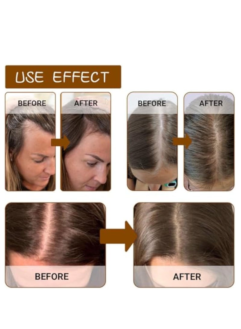 إيلهو مصل نمو الشعر البيوتين ، بخاخ نمو الشعر البيوتين ، علاج مضاد لتساقط الشعر ، مصل نمو الشعر مع البيوتين ، بخاخ سماكة الشعر ، الزيوت الأساسية للعناية بالشعر سريعة النمو ، بخاخ فروة الرأس 30 مل - Image 2