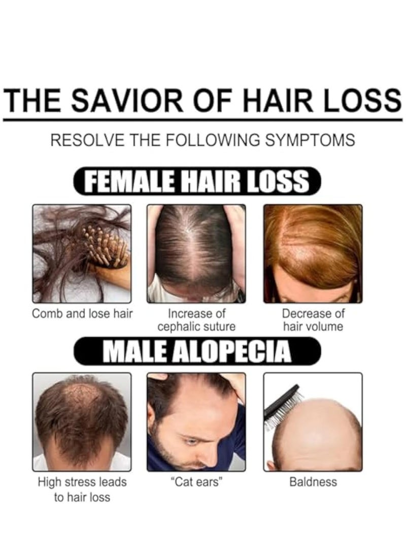 إيلهو مصل نمو الشعر البيوتين ، بخاخ نمو الشعر البيوتين ، علاج مضاد لتساقط الشعر ، مصل نمو الشعر مع البيوتين ، بخاخ سماكة الشعر ، الزيوت الأساسية للعناية بالشعر سريعة النمو ، بخاخ فروة الرأس 30 مل - Image 3