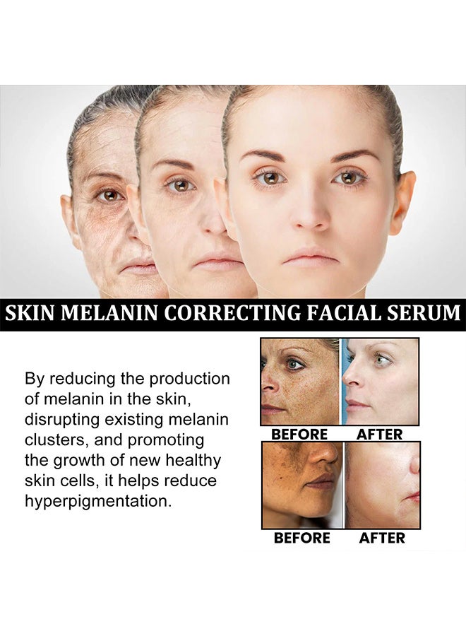 EELHOE melanin repair facial essence, moisturizing and repairing dull skin, whitening and tender skin essence - Image 4