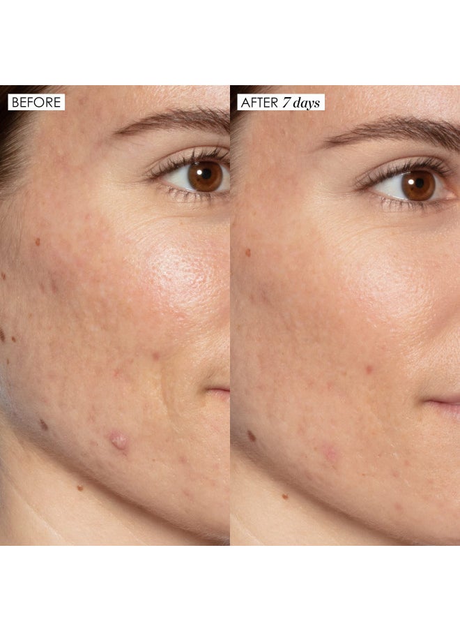Sunday Riley Good Genes All-in-One Lactic Acid Treatment Face Serum