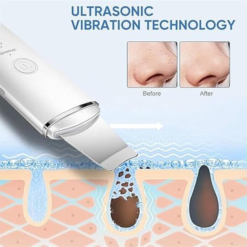 LC Ultrasonic Skin Cleaning Spatula Portable Blackhead Remover Skin Remover Skin Scrubber Waterproof USB Rechargeable for Women Men - Image 3