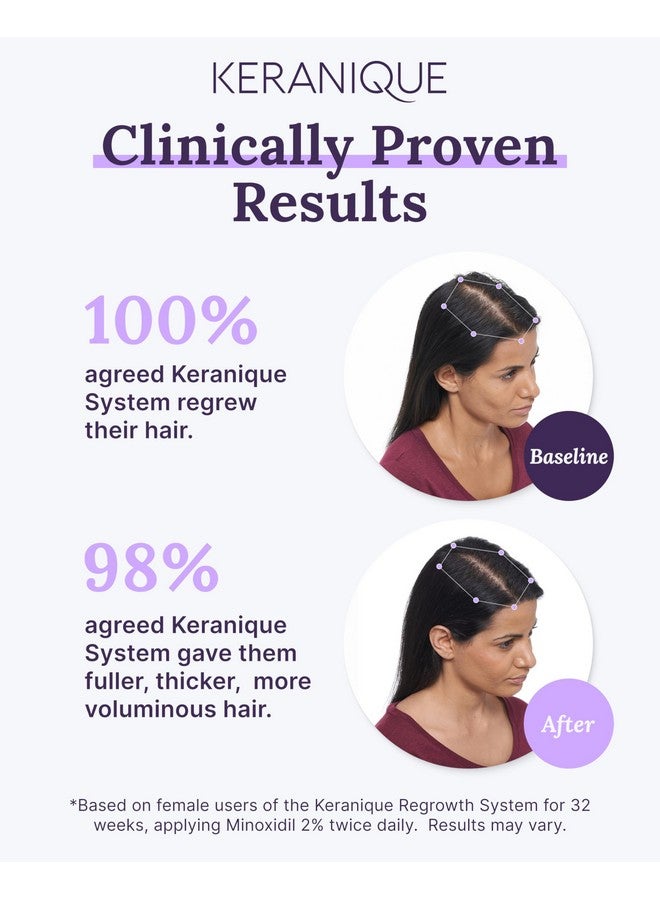 Keranique Women's 5% Topical Minoxidil Foam - Hair Regrowth Scalp Treatment with Powerful NutriGrow blend - Supports Thicker, Fuller, Healthier Hair & Scalp 2 pack - Image 4