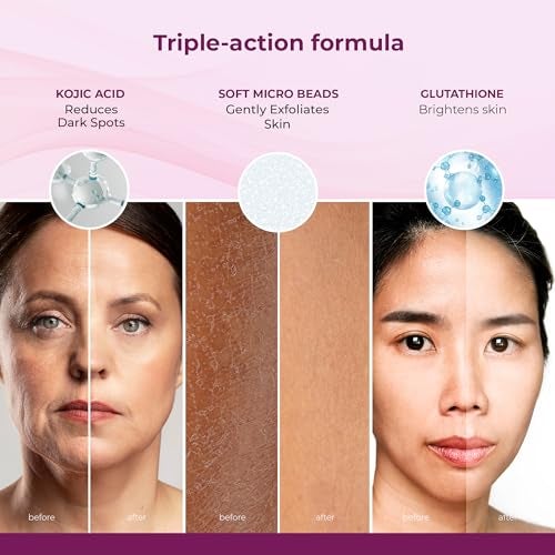 Kozicare Skin Whitening Scrub For Face | Exfoliating Scrub | Scrub For Men & Women Tan Removal Scrub Tanning Dead Skin Removal Gel Kojic Acid Scrub For Blackheads, Whiteheads & Smooth Skin - 100 Gm - Image 3