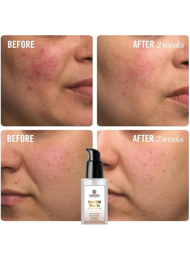 ساميشا سيروم يوسين ساميشا للوجه للرجال والنساء | سيروم مضاد للشيخوخة للنساء والرجال | سيروم للبشرة الجافة | أفضل سيروم لبشرة متوهجة | سيروم الحلزون للبشرة المختلطة - Image 4