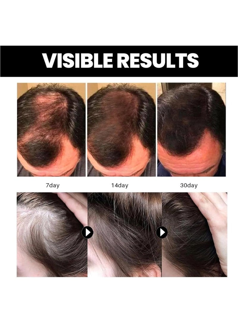 DubaiGallery زيت باتانا، زيت باتانا العضوي لشعر صحي، زيت باتانا لنمو الشعر، زيت باتانا الطبيعي، زيت باتانا للشعر، يعزز صحة الشعر ويزيد من إشراقة الشعر والبشرة - Image 4