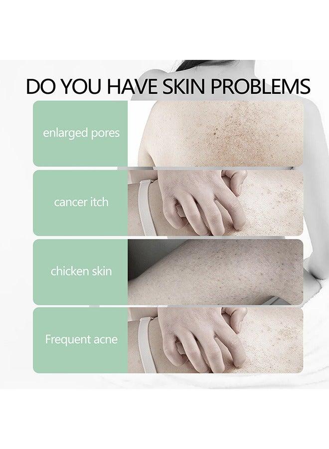 Jaysuing Soothing And Cleansing Keratosis Pilaris and Acne Repair Body Refreshing Cream -Removes Dead Skin,Promotes Acne Removal and Helps Restore The Skin Protective Barrier 48g - Image 5