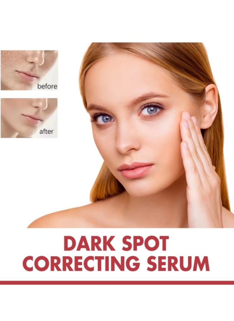 Anua - Hyperpigmentation Correction Serum: 10% Niacinamide + 4% Tranexamic Acid for Acne Scars, Post-Acne Marks, and Even Skin Tone - Image 1