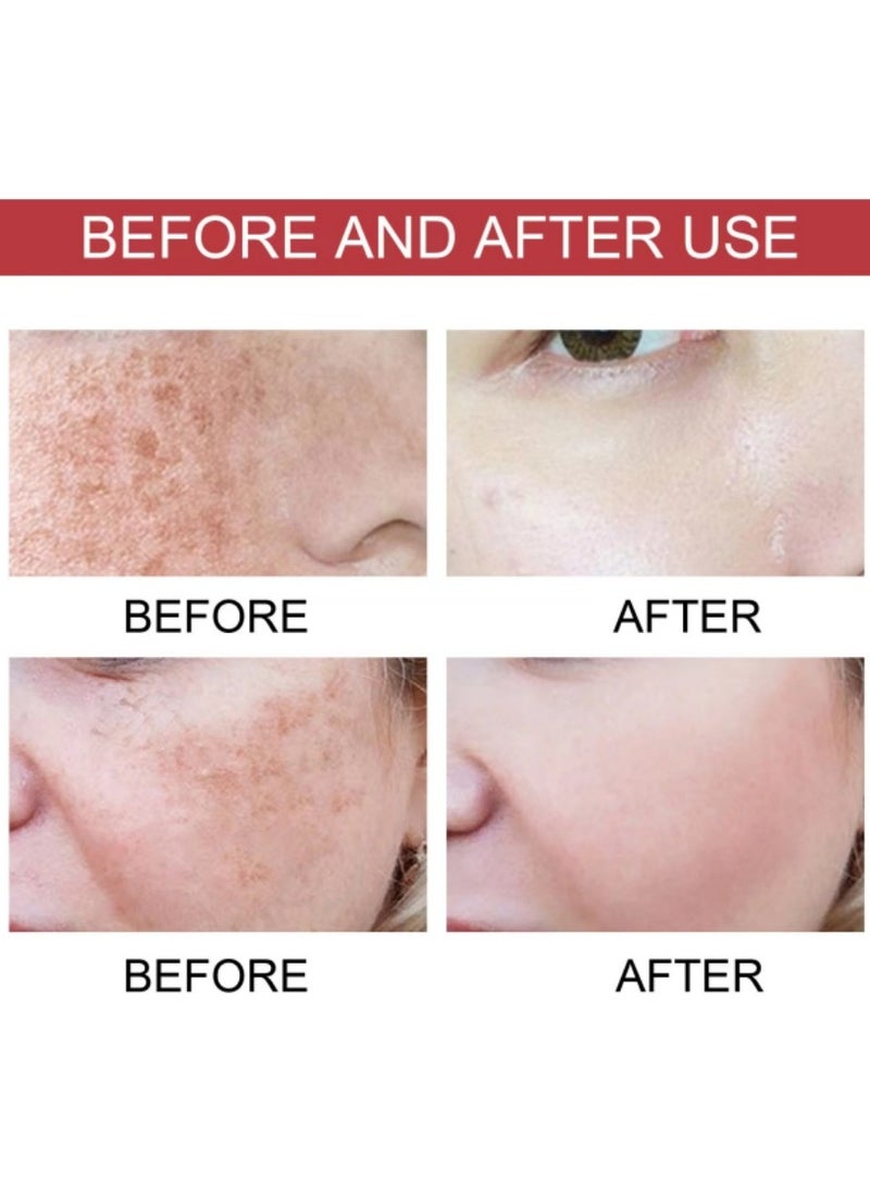 Anua - Hyperpigmentation Correction Serum: 10% Niacinamide + 4% Tranexamic Acid for Acne Scars, Post-Acne Marks, and Even Skin Tone - Image 1