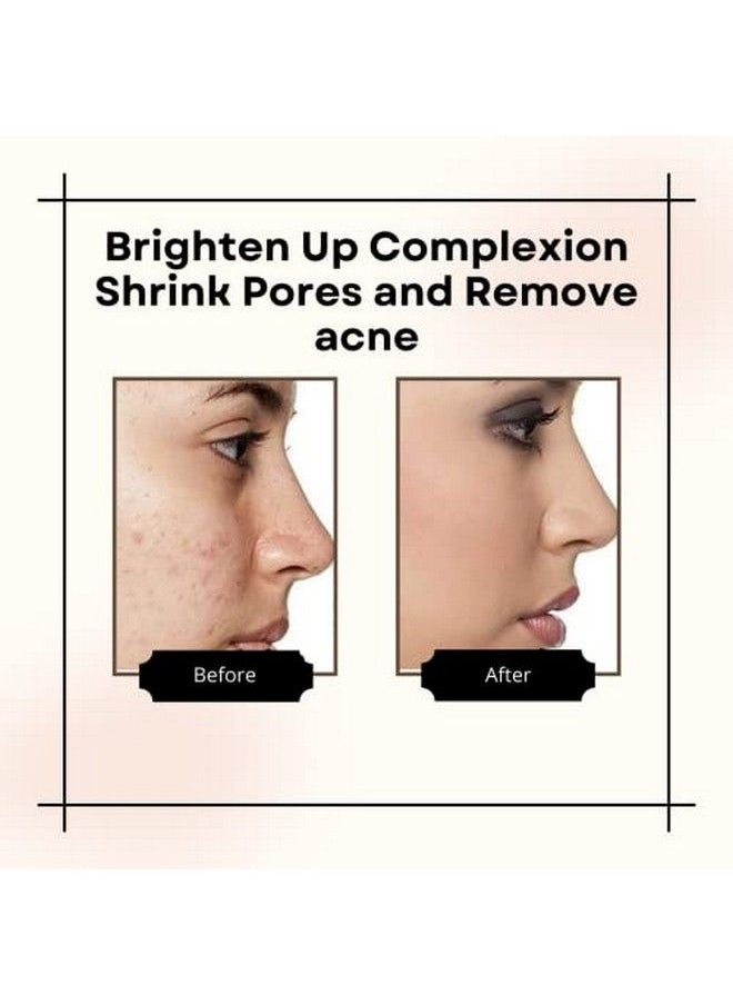 Aravi Organic 20% Vitamin C Face Serum For Face Whitening Men & Women For Skin Brightening Wrinkles Pigmentation & Blemishes (30 Ml)  - Image 4