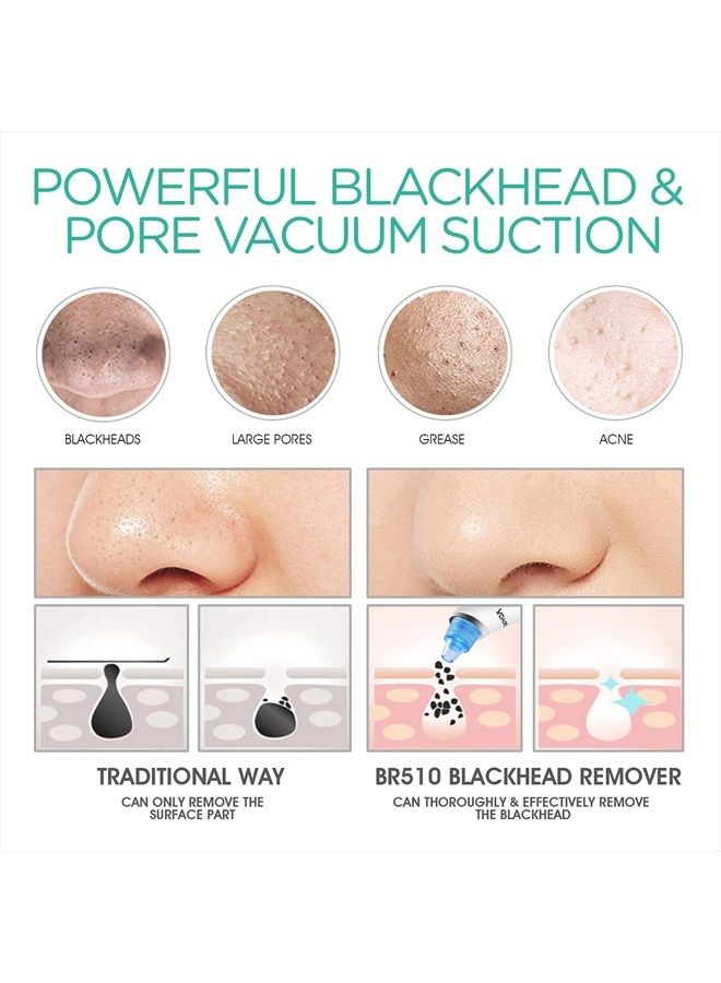VOYOR Blackhead Remover Pore Vacuum - Blackheads Remover Tools Electric Face Vacuum Pore Cleaner Acne Whiteheads Extractor with 6 Suction Heads and 5 Suction Levels for Men and Women BR510 - Image 3