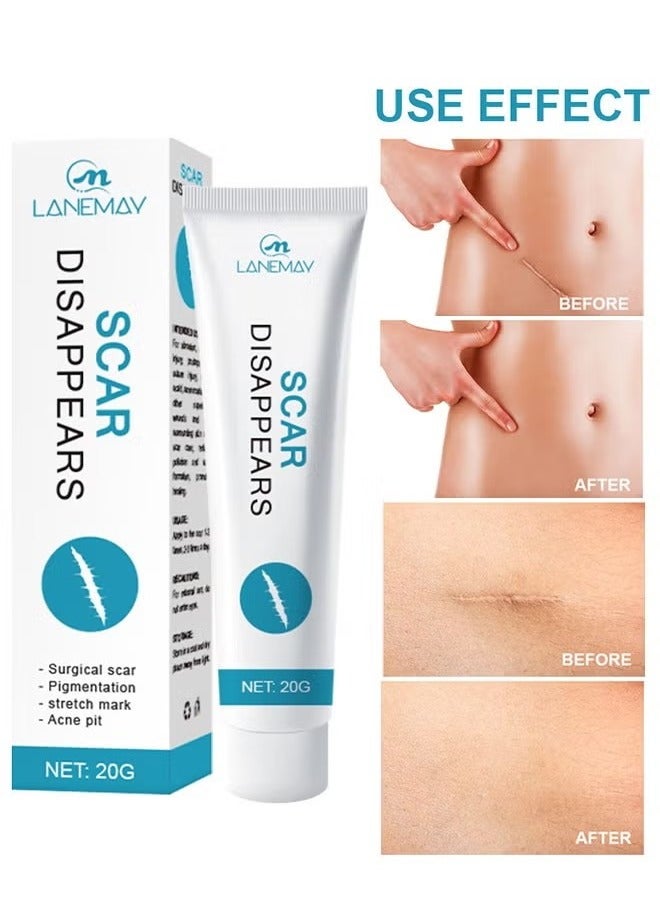 LANEMAY Scar Disappears-Medical Grade Silicone Scar Cream Advanced Scar Removal Gel For Surgical Scars Stretch Marks Acne Injury Burns Keloids Hypertrophic Old And New Scars - Image 1