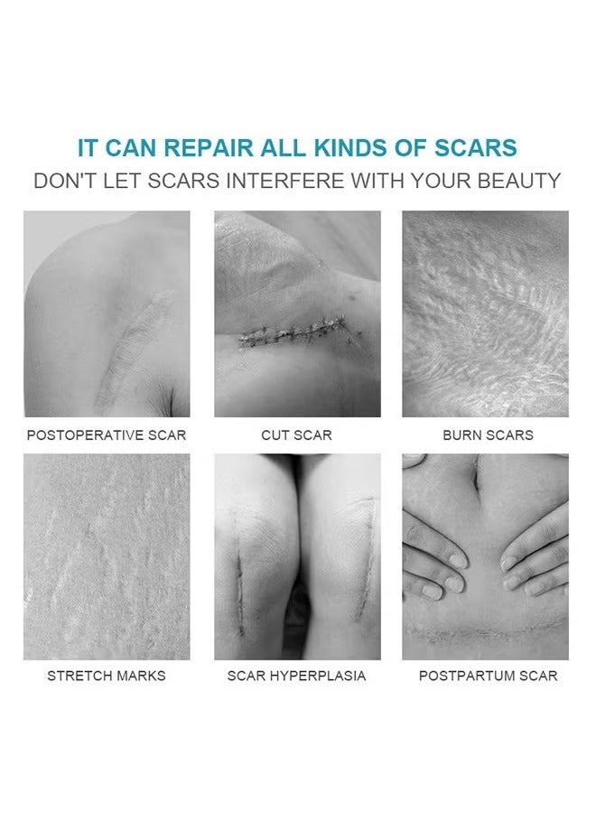 LANEMAY Scar Disappears-Medical Grade Silicone Scar Cream Advanced Scar Removal Gel For Surgical Scars Stretch Marks Acne Injury Burns Keloids Hypertrophic Old And New Scars - Image 3