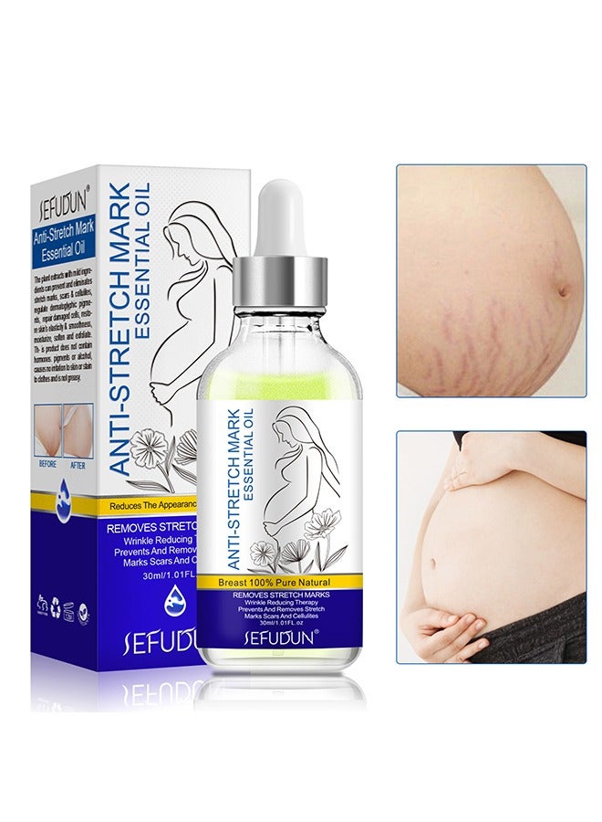 Sefudun Anti-Stretch Mark Essential Oil - Stretch Marks And Scar Removal Oil For Pregnancy Stretch Marks Scar Belly Oil, For Wrinkles Obesity Stretch Mark Moisturizing Remove Marks 30ML - Image 1