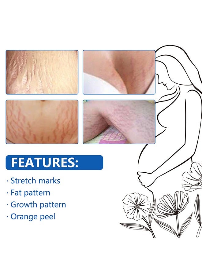 Sefudun Anti-Stretch Mark Essential Oil - Stretch Marks And Scar Removal Oil For Pregnancy Stretch Marks Scar Belly Oil, For Wrinkles Obesity Stretch Mark Moisturizing Remove Marks 30ML - Image 3