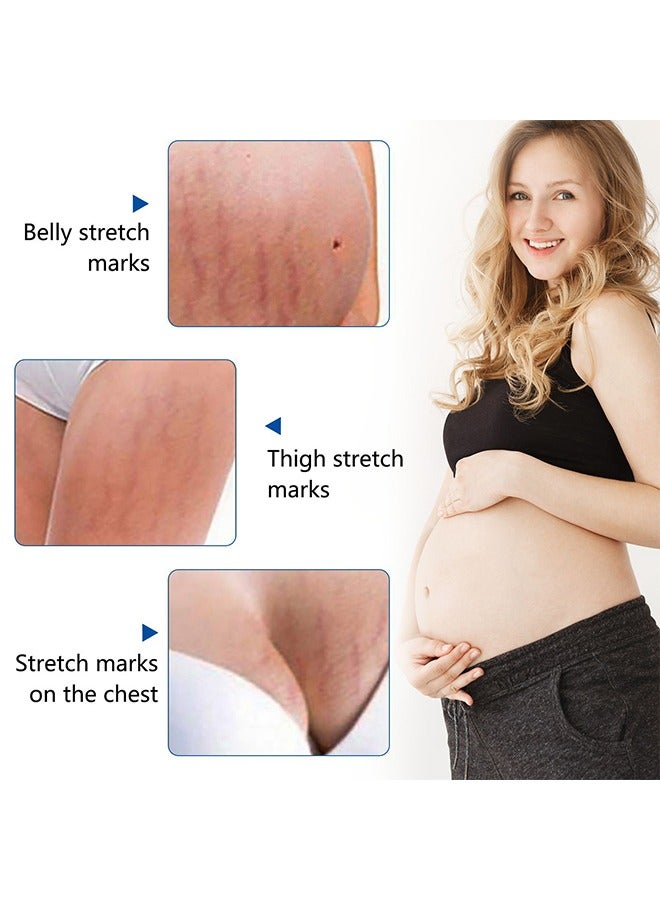 Sefudun Anti-Stretch Mark Essential Oil - Stretch Marks And Scar Removal Oil For Pregnancy Stretch Marks Scar Belly Oil, For Wrinkles Obesity Stretch Mark Moisturizing Remove Marks 30ML - Image 4