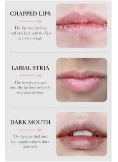 SADOER LIGHTEN LIP WRINKLES  - Image 3