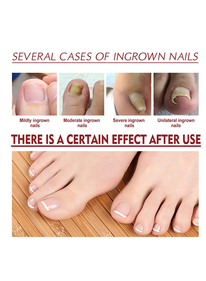 Jaysuing Toenailcare Removal Paronychia Oil - Bunion Therapy Oil - Toenailcare Anti Paronychia Relief Oil Repair For Damaged Discolored Thick Nails 10ML - Image 4