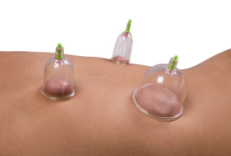 Sampton طقم كؤوس الحجامة 6 قطع مجموعة كؤوس الحجامة الصحية المحمولة للاسترخاء الجسم جهاز تدليك احترافي - Image 5