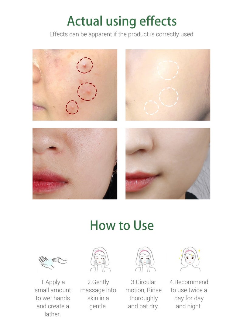 BREYLEE Tea Tree Acne Cleanser Facial Cleanser 100g - Image 3