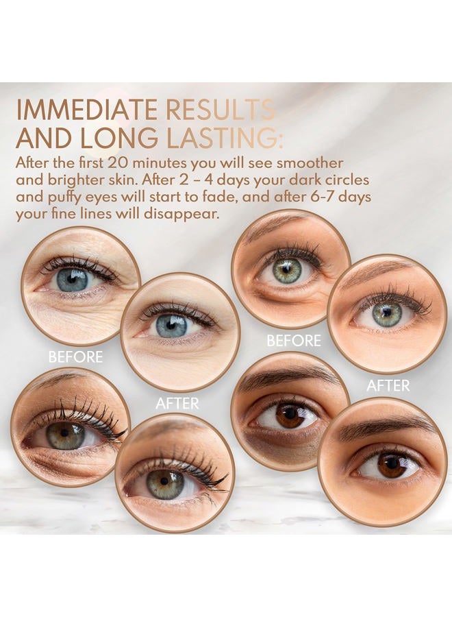 Alayna Under Eye Anti-Aging Eye Mask Collagen Patch Treatment for Minimizing Wrinkles, Puffy Eyes, Eye Bags, Dark Circles, Fine Lines Under the Eye, Looking Less Tired, Revitalizing, Moisturizing and Refresh - Image 4