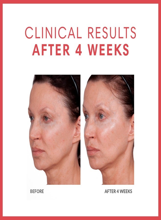 Consult Beaute Volumagen TRIO Skin Care For Plumper & Smoother Skin - Collagen, Hyaluronic Acid and Ceramides - Doctor Formulated for Face, Neck and Eyes - Boost Moisture for Glowing Complexion - Image 3