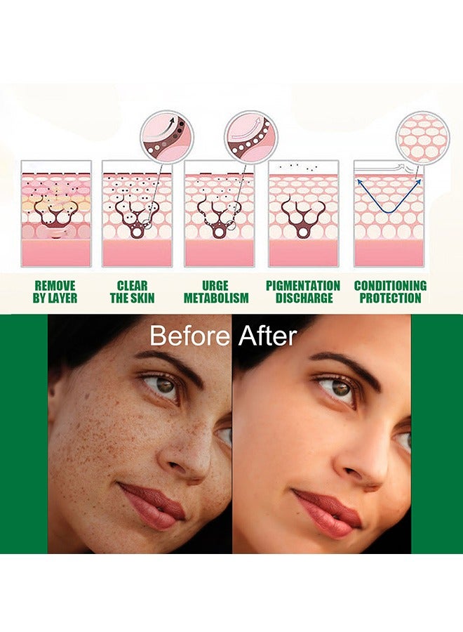 EELHOE Dark Spot Correcting Glow Serum - Moisturizing Whitening Brightening Serum - Dark Spot Treatment - Repair Dullness, for Acne Scars, Fine Lines, Hyperpigmentation and Dark Circles 50ml - Image 4