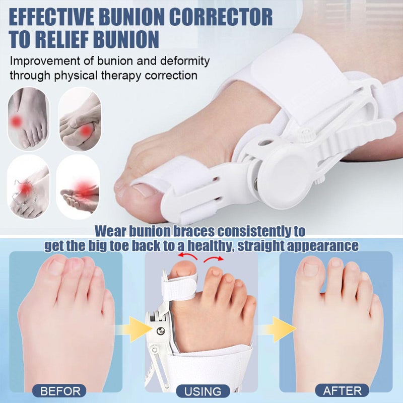 Fittakan Recovist Bunion Corrector for Women & Men- Upgraded Tailors Big Toe Straightener Orthopedic Bunions Splint for Hallux Valgus Pain Relief Hammer Toe Straightener Left/Right Feet- 2PC Grey - Image 3